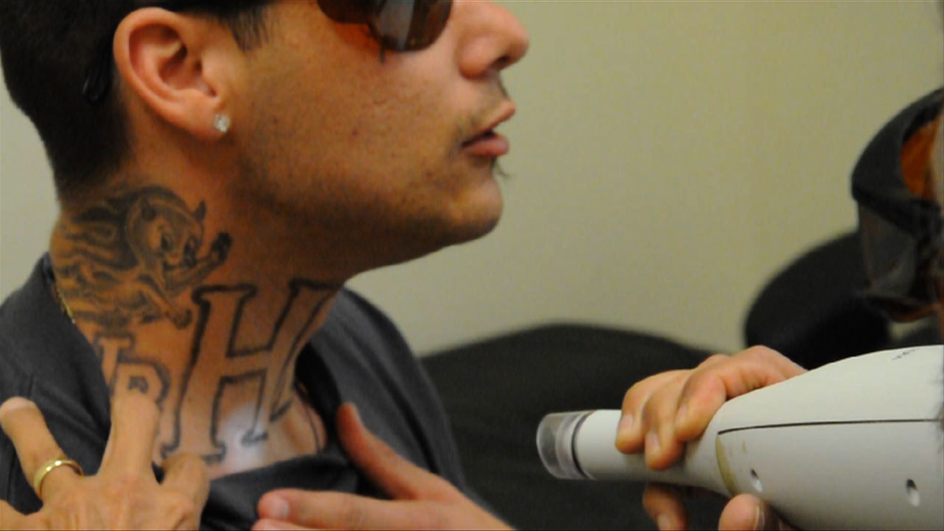 Gabriel Hinojos 29 receives tattoo removal laser surgery at Homeboy  Industries by volunteering do