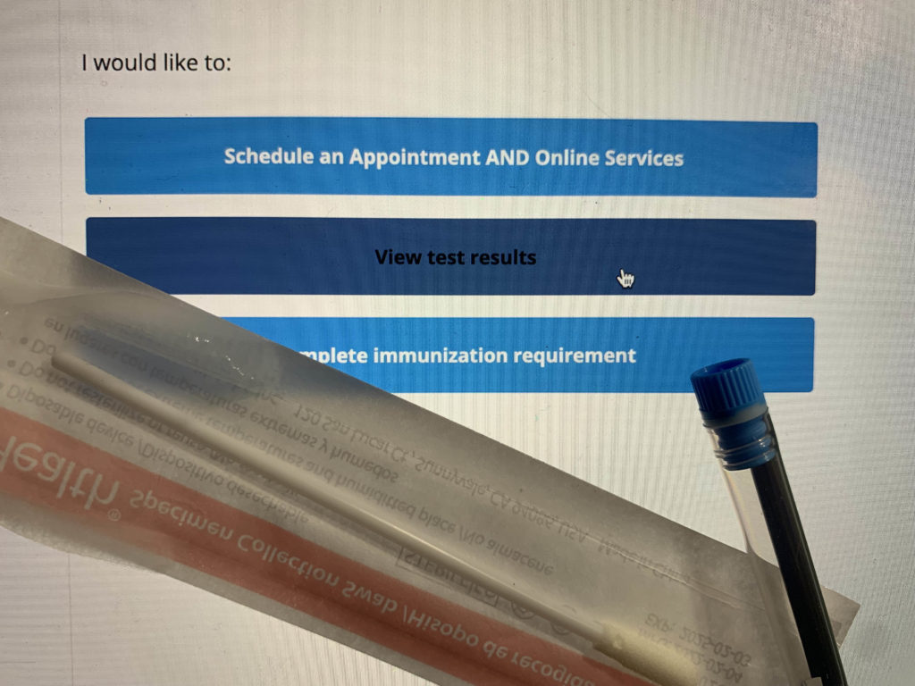 UCLA Planned Parenthood chapter seeks to offer free STI testing during