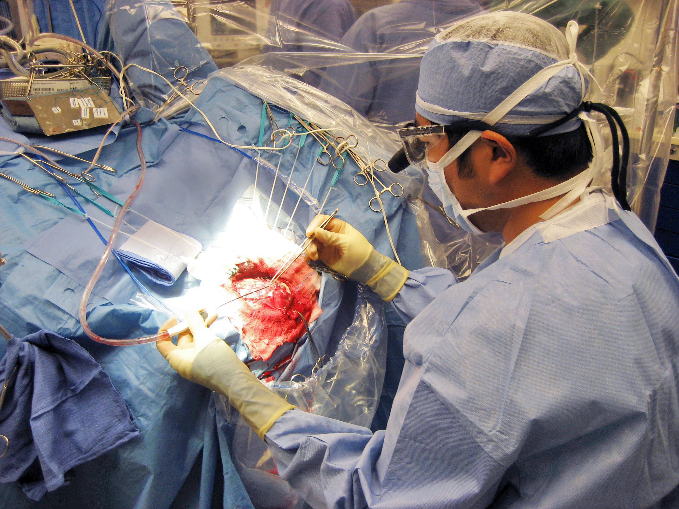 neurosurgeons operating